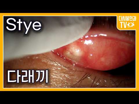 Видео: Разрез ячменя