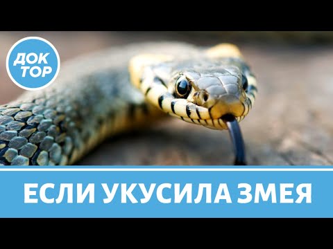 Видео: Первая помощь при укусе змеи