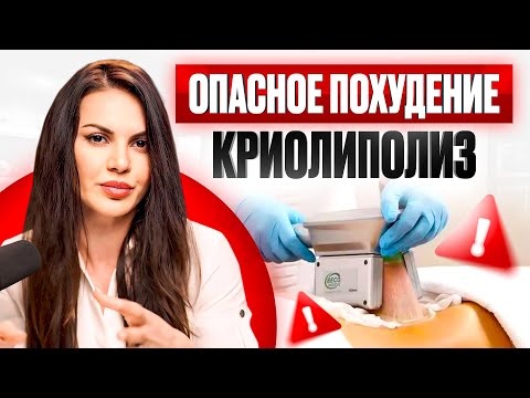 Видео: БЕЗОПАСЕН ЛИ КРИОЛИПОЛИЗ? Все возможные последствия процедуры!
