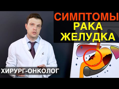Видео: Симптомы рака желудка. Признаки злокачественной опухоли желудка