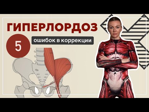 Видео: Как убрать ГИПЕРЛОРДОЗ. 5 ошибок в коррекции. Рабочие и не рабочие упражнения