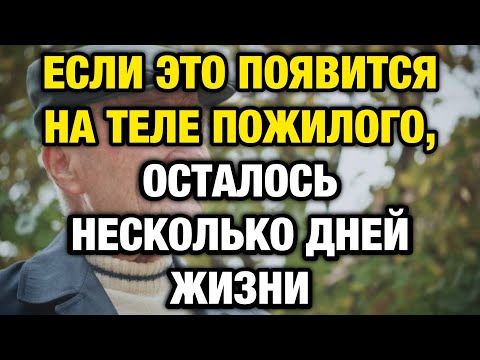 Видео: Если это появилось в вашем теле — смерть может быть ближе, чем вы думаете…