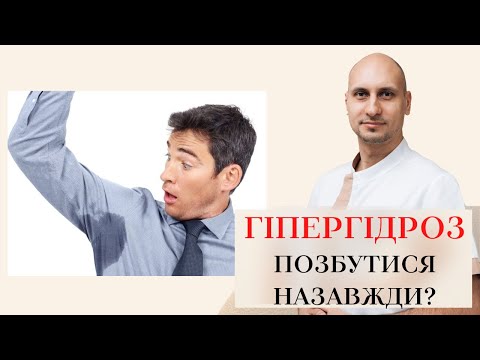 Видео: ГІПЕРГІДРОЗ 🤮ПІДВИЩЕНА ПІТЛИВІСТЬ ⁉️ ЛІКУВАННЯ ГІПЕРГІДРОЗУ 💉