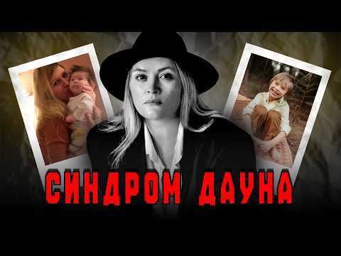 Видео: Синдром Дауна: "Я приму этот вызов"