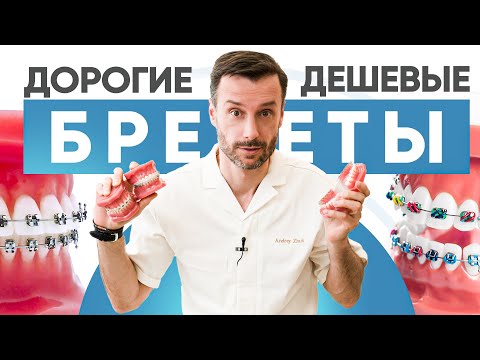 Видео: Самые дорогие и самые дешевые брекеты – в чем разница?