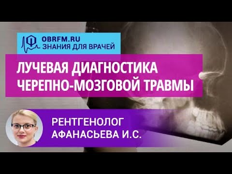 Видео: Рентгенолог Афанасьева И.С.: Лучевая диагностика черепно-мозговой травмы