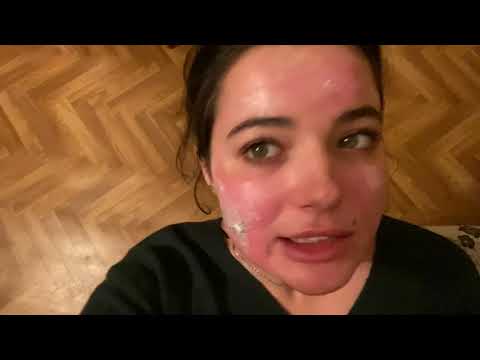 Видео: Лазерная шлифовка лица лазером CO2. РЕАЛЬНЫЙ процесс восстановления и результат до и после