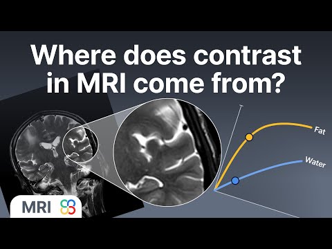 Видео: Откуда берётся контраст на снимке МРТ? - Объяснение физики МРТ