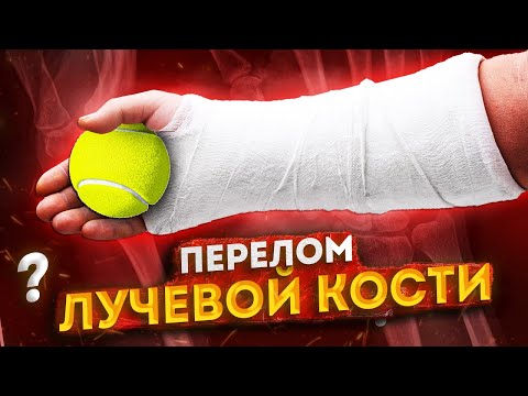 Видео: Перелом лучевой кости. Что делать после снятия гипса?