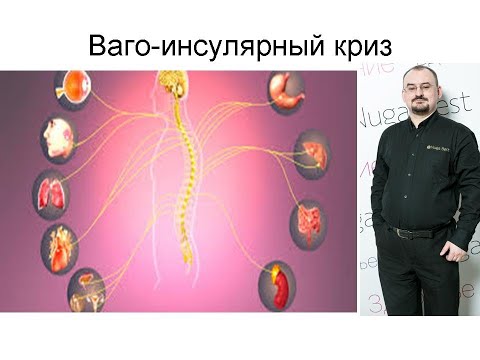 Видео: Ваго-инсулярный криз. Его проявления.