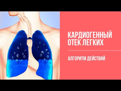 Видео: Неотложные состояния: Отек легких.