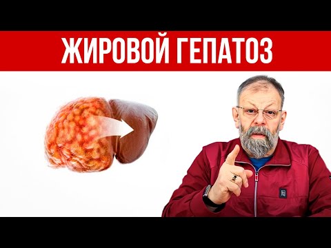 Видео: Жировой гепатоз (ожирение печени). Как очистить печень от жира?