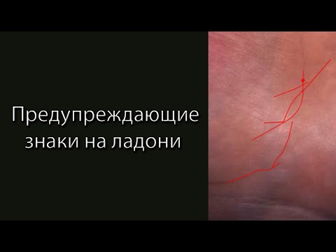 Видео: Предупреждающие знаки на ладони #хиромантия