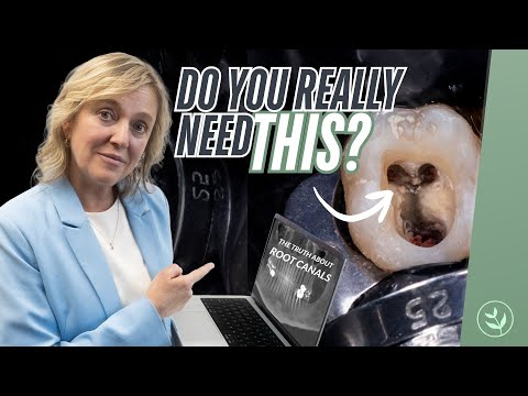 Видео: Вам ДЕЙСТВИТЕЛЬНО нужно лечение корневых каналов? Стоматолог раскрывает правду