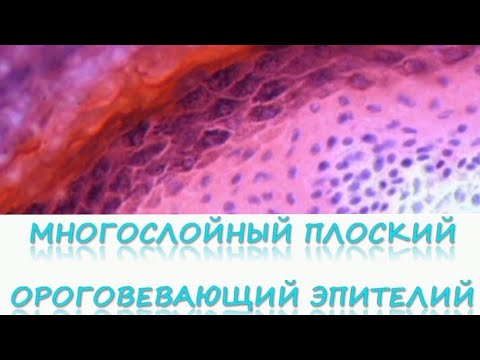 Видео: МНОГОСЛОЙНЫЙ ПЛОСКИЙ ОРОГОВЕВАЮЩИЙ ЭПИТЕЛИЙ