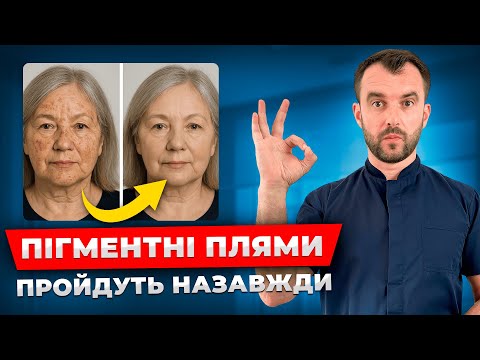Видео: Зробіть це і ваша шкіра буде молодою! Пігментні плями: причини, як лікувати