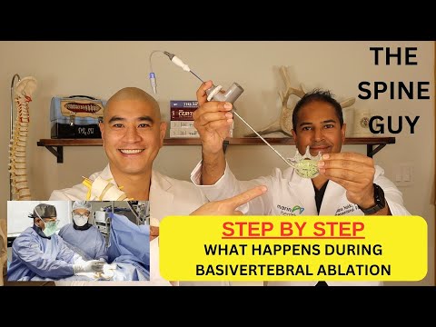 Видео: Процедура Интрацепт при болях в спине: что происходит во время базивертебральной абляции?