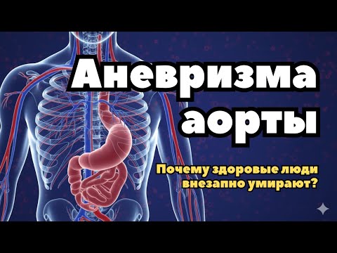 Видео: Аневризма аорты. Почему здоровые люди внезапно умирают?