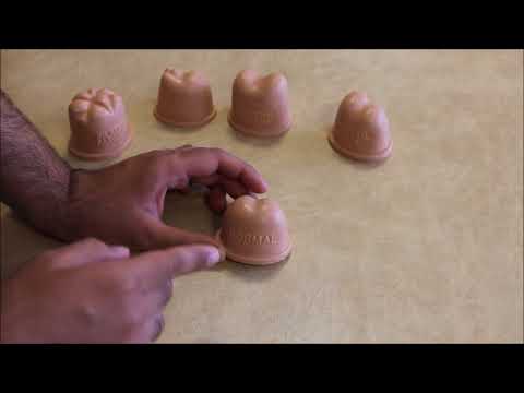 Видео: Перректальное и простатическое исследование