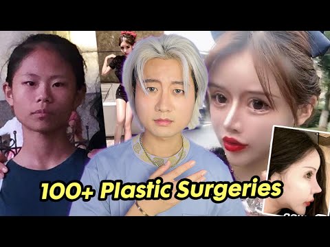 Видео: Самый молодой инфлюенсер в мире пластической хирургии в 16 лет