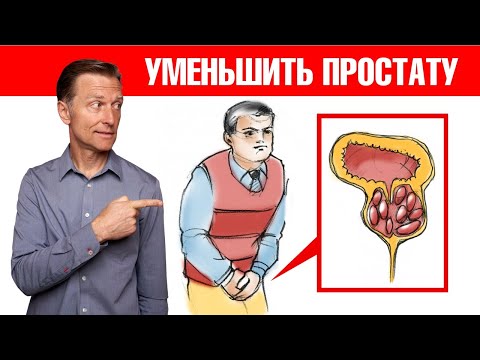 Видео: Аденома простаты👉как решить проблему с увеличенной простатой