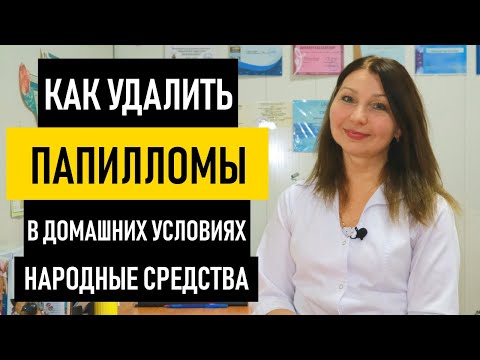 Видео: Как Удалить Папилломы в домашних условиях. Лечение и удаление папиллом народными средствами