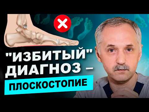 Видео: Влияние ПЛОСКОСТОПИЯ на здоровье! Что нужно знать каждому? / Доктор Виктор