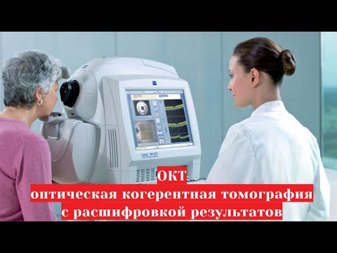 Видео: ОКТ - оптическая когерентная томография 👀 сетчатки и зрительного нерва с расшифровкой результатов