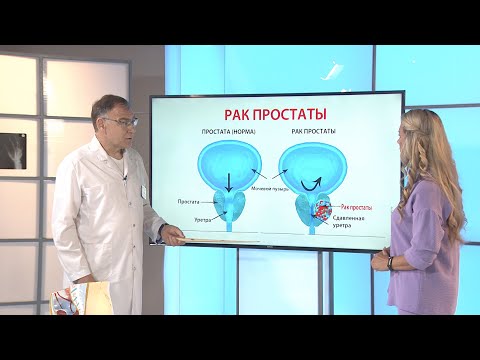 Видео: АДЕНОМА И РАК ПРЕДСТАТЕЛЬНОЙ ЖЕЛЕЗЫ.