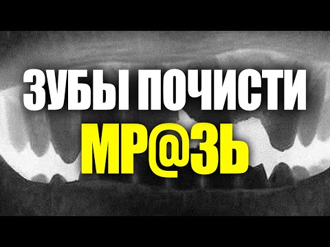 Видео: Съел пельмени. Пришлось идти к врачу.