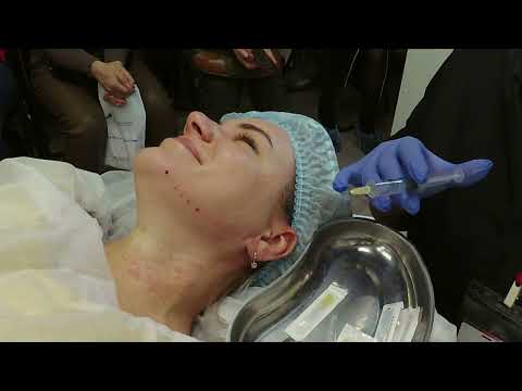 Видео: Практический мастер-класс по мезотерапии