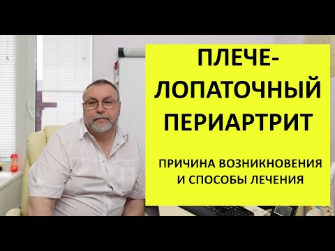 Видео: Плечелопаточный периартрит. Почему возникает и как лечить.