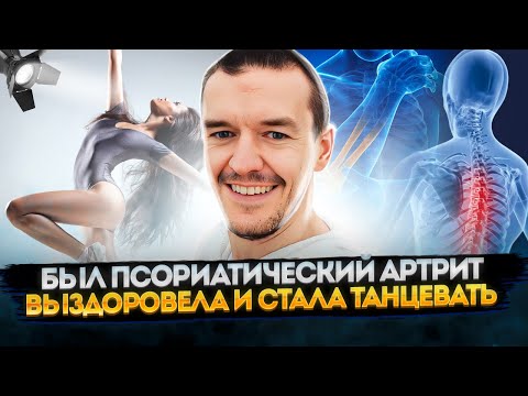 Видео: Был псориатический артрит - выздоровела и стала танцевать