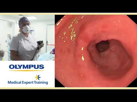 Видео: Диагностика лимфомы желудка с применением уточняющих методик. Малихова О. А.