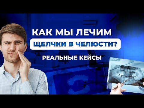 Видео: Щелчки в челюсти при открывании рта. Как лечат? Разбор случаев из практики