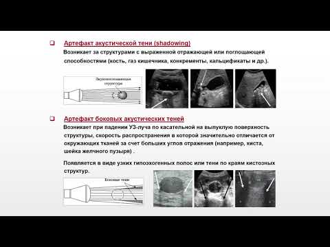 Видео: Ультразвуковая диагностика (УЗИ). Доктор Иогансен. Выпуск 4. Артефакты в ультразвуковой диагностике.