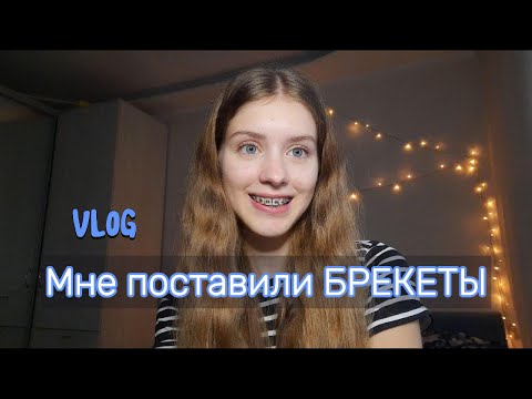 Видео: Мне установили БРЕКЕТЫ | Первая неделя с ними | Влог