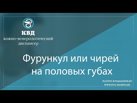 Видео: 1074  Фурункул или чирей на половых губах