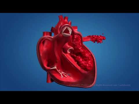 Видео: Сердце:3D-анимация работы сердца и кровообращения организма. Большой и малый круги кровообращения