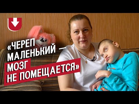 Видео: У моего сына микроцефалия: Аня | Быть мамой