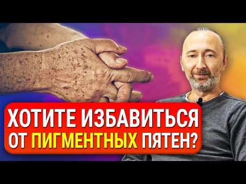 Видео: Как избавиться от пигментных ПЯТЕН на лице и теле? Причины появления. Старческие пигментные пятна.