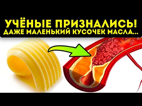 Видео: Вот она - правда! Реакция холестерина на сливочное масло вас удивит!