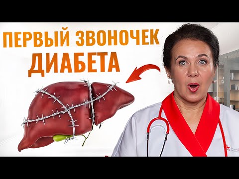 Видео: ПОСТОЯННАЯ УСТАЛОСТЬ — это первый звоночек ДИАБЕТА! Что делать после 50 лет?