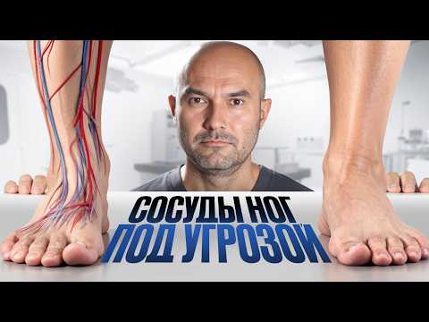 Видео: Забитые сосуды ног — как распознать без врача за 5 минут