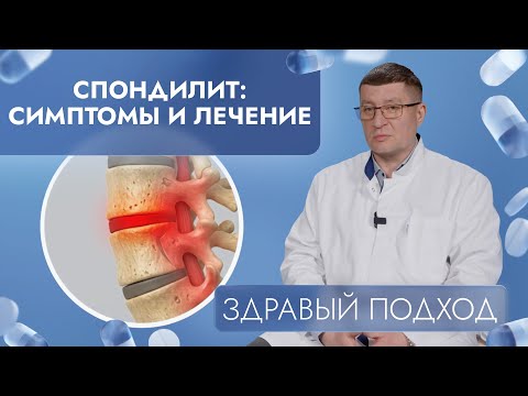 Видео: Спондилит: симптомы и лечение | Здравый подход (2025)