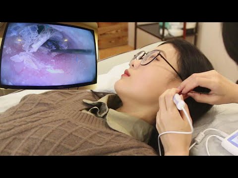 Видео: 【ASMR】Попробуйте самую профессиональную чистку ушной серы и расслабляющий массаж ушей!