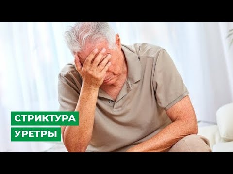 Видео: Стриктура уретры
