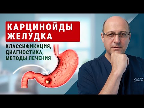 Видео: Карцинойды желудка: классификация, диагностика и методы лечения | доктор Юрий Гольдес