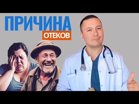 Видео: Причины отеков, о которых не подозревал. Врач раскрыл правду о которой не расскажут в поликлинике 