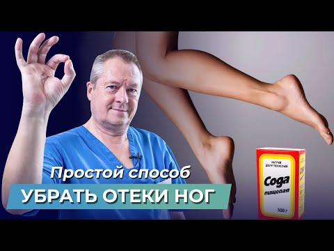 Видео: Избавьтесь от ОТЕКОВ ног с помощью 1 процедуры! Отекают ноги: что делать? Отёки на ногах лечение